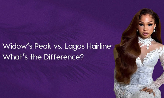 Widow's Peak vs. Lagos Hairline: What's the Difference?
